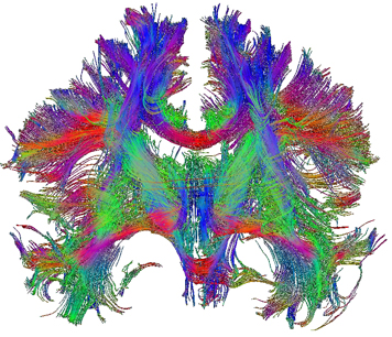 Fiber reconstructions in the human brain