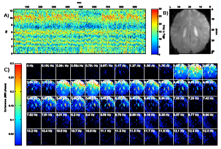 Coherence in vivo before removal of BCG artefact