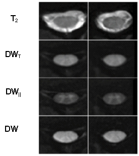 T2(b0) and DW images with diffusion weighting applied perpendiculat and parallel to the spinal cord