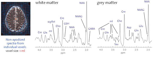 Enlarged view: In vivo 1H FIDLOVS MRSI at 7T